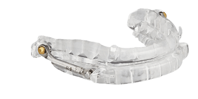 ProSomnus PH oral appliance example
