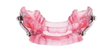 SomnoMed Herbst Advance oral appliance example